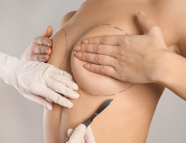 Lipofilling Mammaire Tunisie